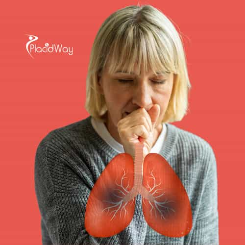 Tratamiento del cáncer de pulmón en México: Terapias inmunológicas y alternativas 